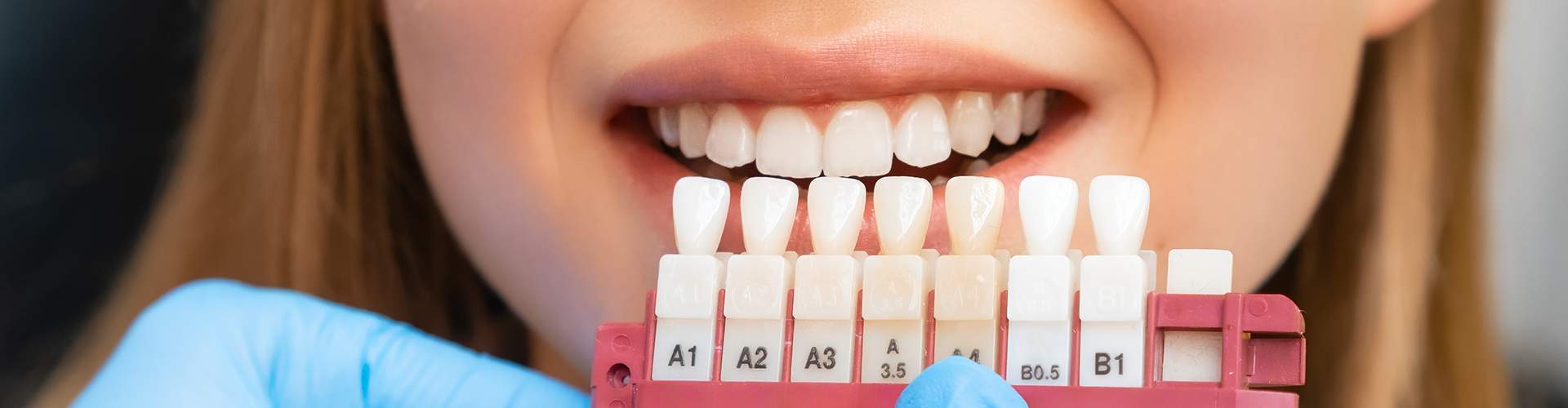 gloved hands-holding tooth shade-matching tool against woman's smile